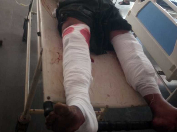 My Father Is Struggling With Leg and Eye injury