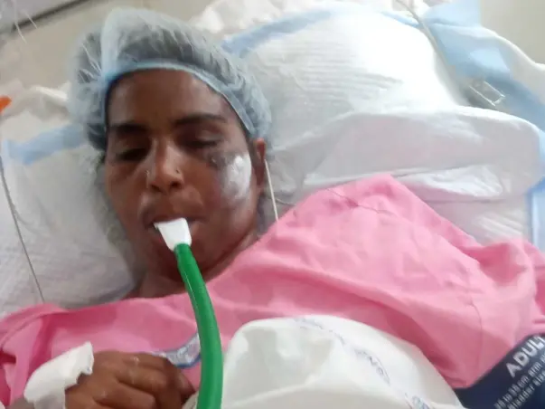 Support Jyoti Recover From Accident Ribs Fracture