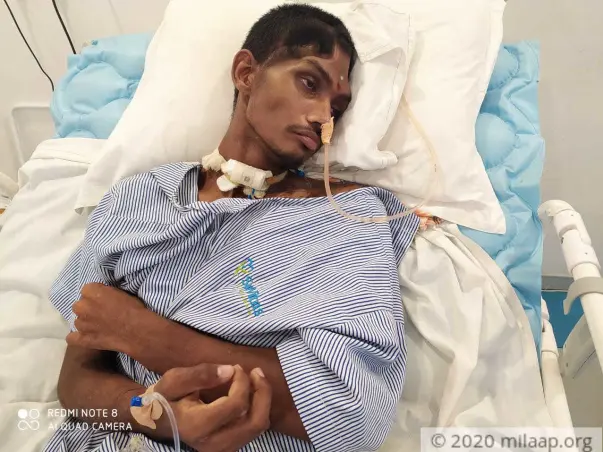 Tragic Accident Left His Younger Brother On The Verge Of Death