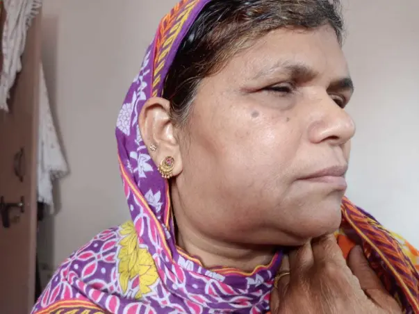 Help Sara Banu Fight Cancer