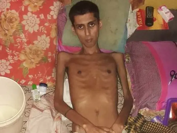 Support Ishan Chatterjee Recover From Pulmonary Tuberculosis