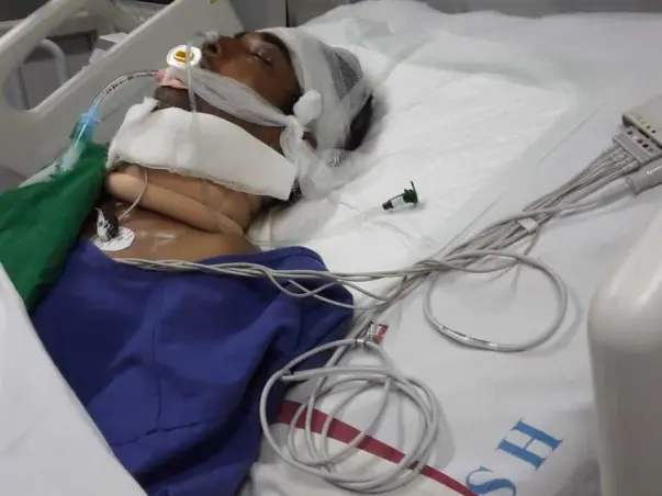 My Father Is Struggling With Accident (Head Injury), Help Him