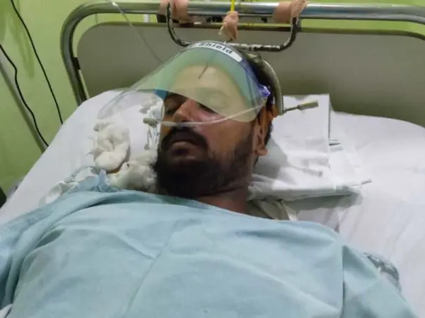 Help my brother to recover from cervical fracture