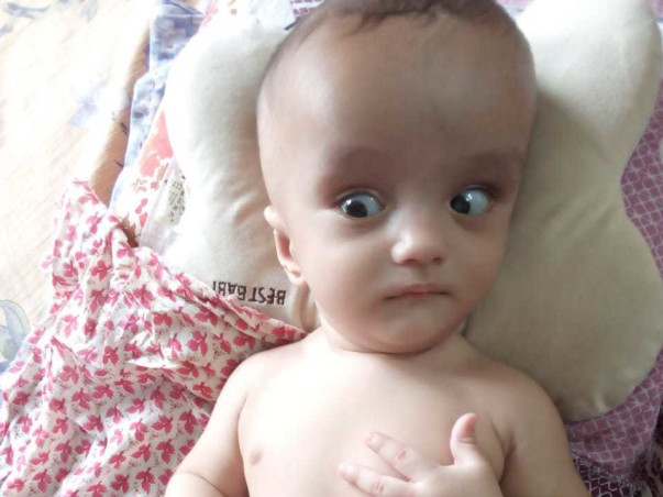 This 5-Month-Old Can Turn Completely Blind Without An Urgent Surgery