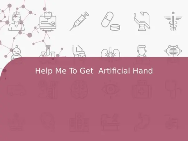 Help Me To Get  Artificial Hand