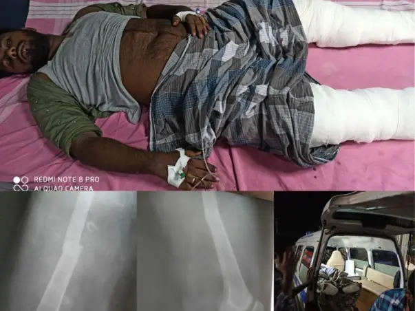 Help My Friend Shahul Hameed Recover From His Accident