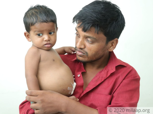 Street Vendor Struggles To Save His 1-Year-Old From Failing Liver