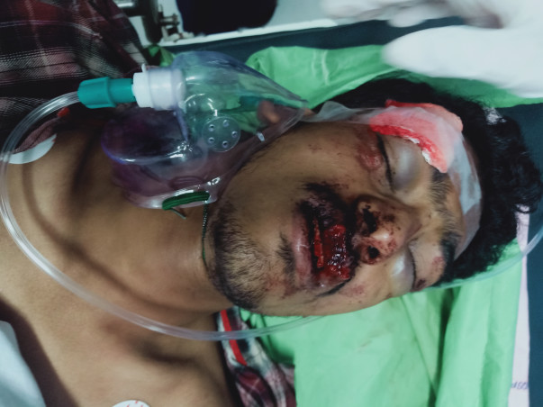 Please Help Vinay who met with an Accident