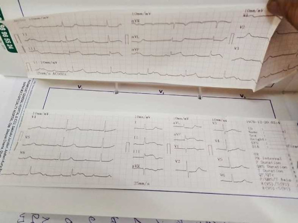Please Help Shehnaz for Surgery