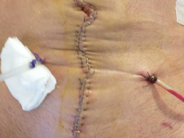 Help my Dad fight cancer