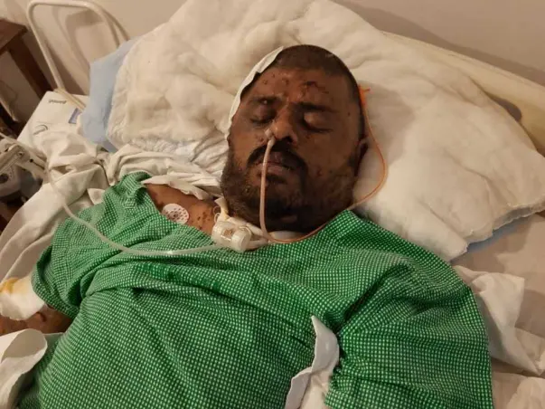 Help Krishna Chaitanya to Recover Brain Injury
