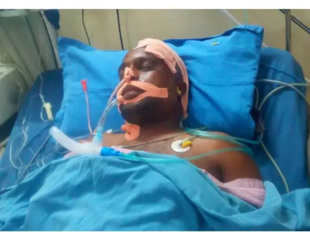 Support Surya Narayana Murthy Recover From Accident Head Injury