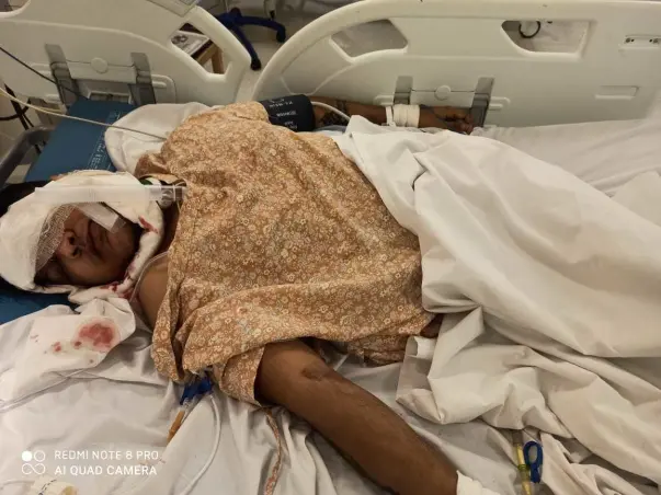 Help my friend Ritesh Singh Dhanik fight Road traffic accident with polytrauma