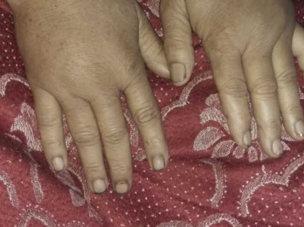 Support terminally ill Afroza live her life with dignity