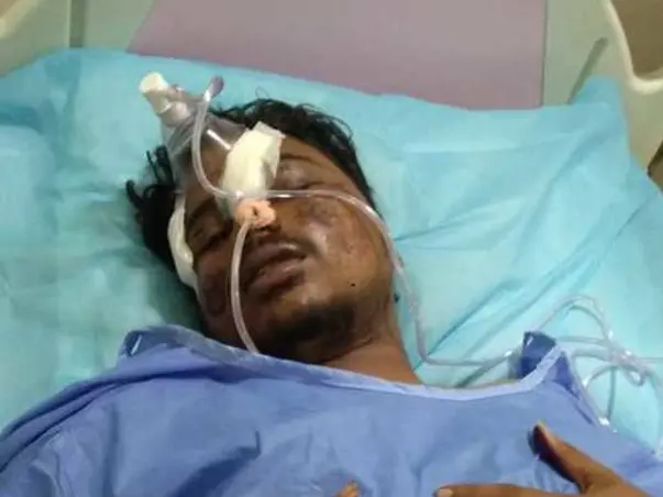 My Brother Needs Your Urgent Support In Fighting Accident (Head Injury)
