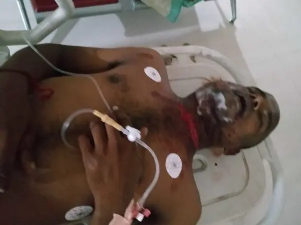 This 22 Years Old Needs Your Urgent Support In Fighting Accident (Head Injuries)