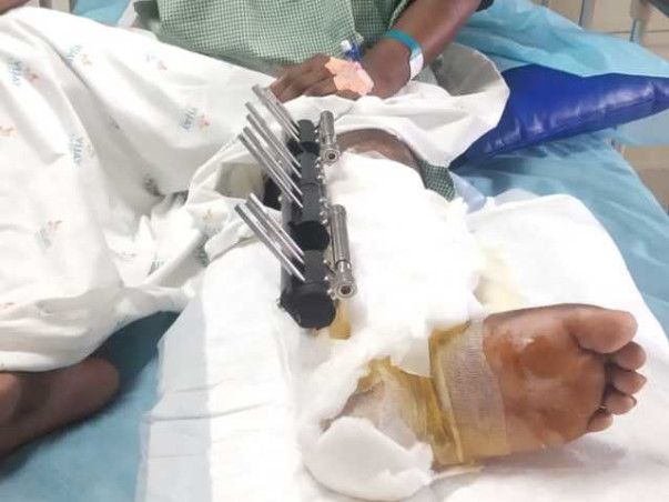 This 26 years old needs your urgent support in fighting Leg surgery