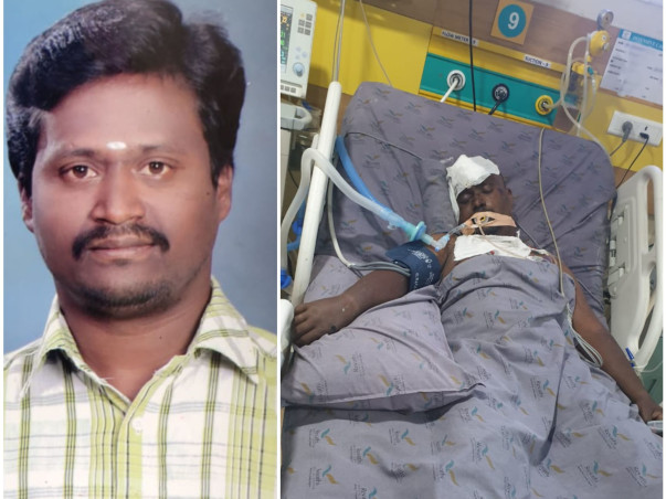 Support S Baskaran Recover From Accident Head & Leg Injury