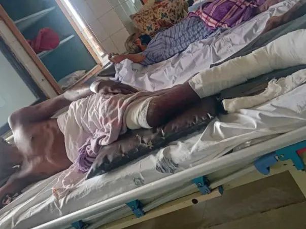 Support Vaketa Subba Reddy Recover From Accident Leg Injury