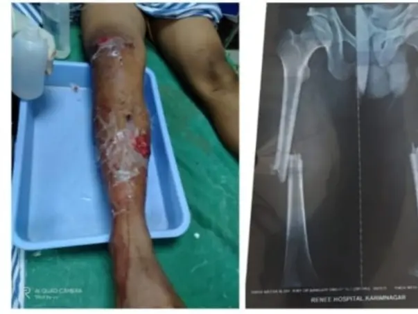 Support Shiva Nayak Recover From Accident