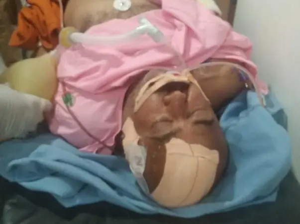 Help my father recover from Brain Hemorrhage
