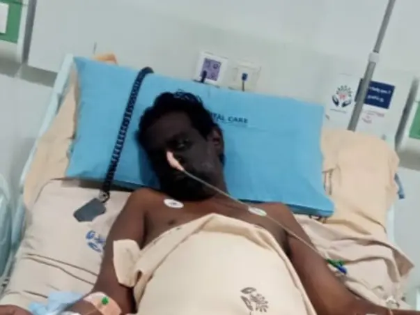 Urgent help for colectomy