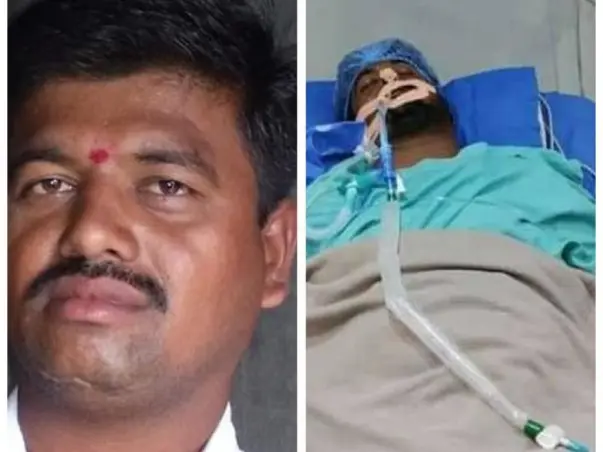 Help My Uncle Rahul To Recover!
