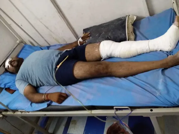 Support Nikhil Gupta to Recover From Accident (Leg and Face Injury)