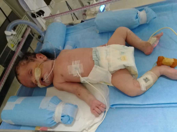 This 28 Days Old Needs Your Urgent Support To Undergo NICU Care