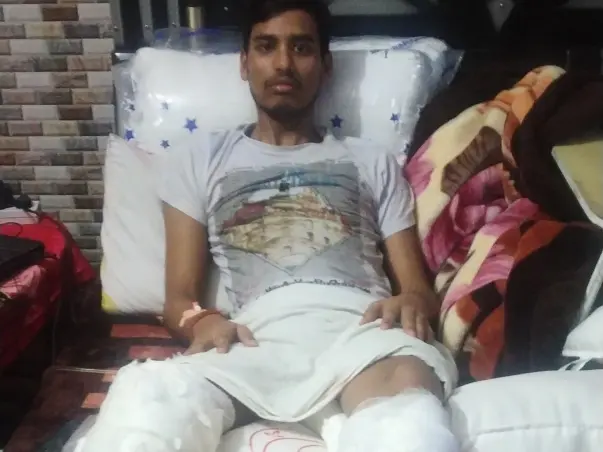 Support Pranjal Recover From Accident Leg Injury