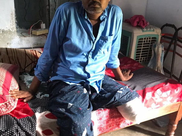 Support Katragadda Malleswara Rao To Get Prosthetic Leg