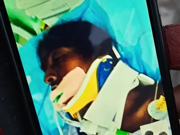 Support Eswaramma Recover From Multiple Organ Disorder