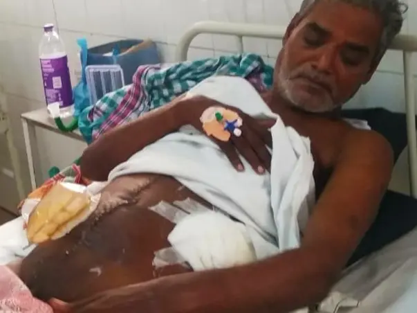 Help My Father Recover From Colorectal Cancer