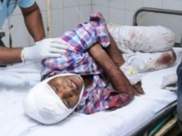 Support Durga Charan Recover From Accident (Head Injury)