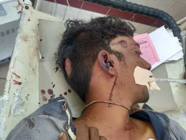 Support Arjun To Recover From Accidental Injuries