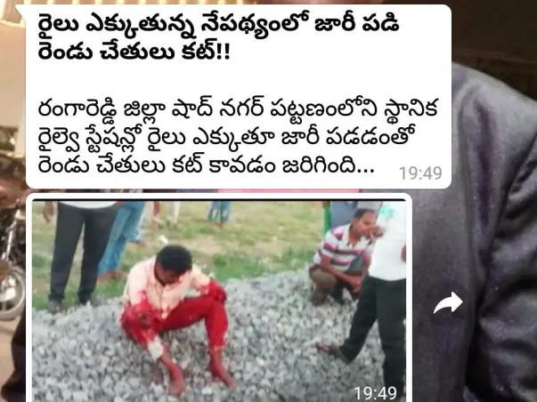 Shaboddin  As He Lost His 2 Hands, Transplant Need Help