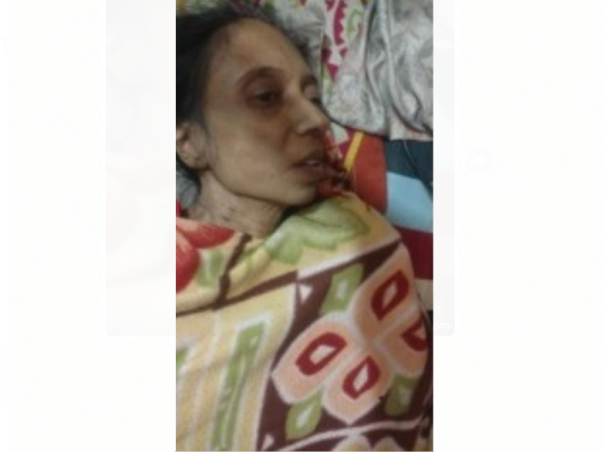Help My Mother Fight Both Kidney Fail And Right Kidney Cancer Stage 2