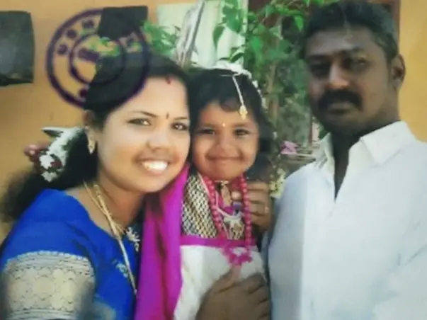Support Venilla Recover From Multiple Skull Fracture
