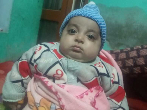 Chintu has already lost his 1st Son, Please help to save his 2nd Son.