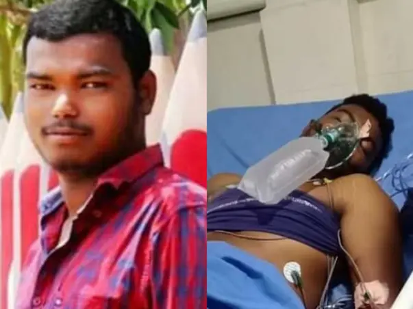 Help 21 Year Old Sai Kumar Recover From Chronic Liver Disease