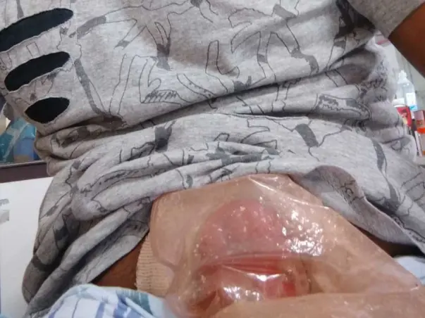 Help My Brother Fight Lymphoma