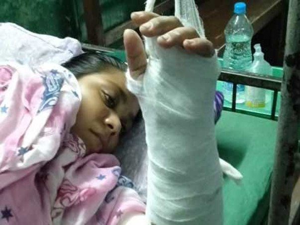 Help Runa : Broken Arms : Domestic Violence