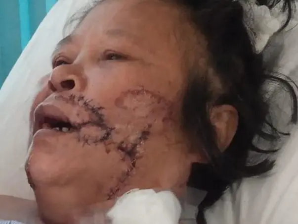 Help my mother k. Neikhochin kom to recover from medical Problems