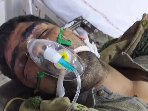 Help My Brother Recover From Head injury