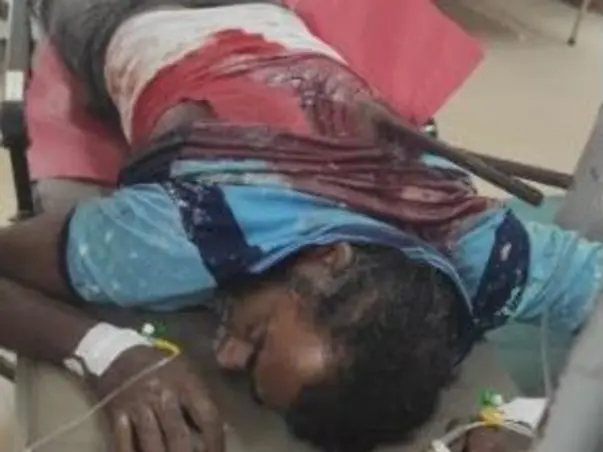 Help Painter Basheer to Save his Life