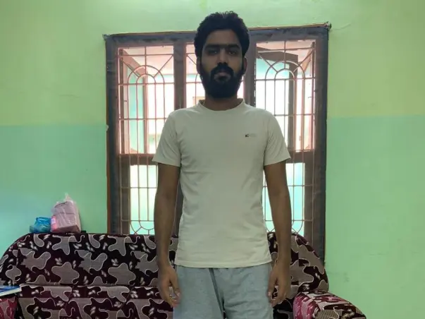 Support Abdulriyasudeen Recover From Prosthetic Leg With in few days
