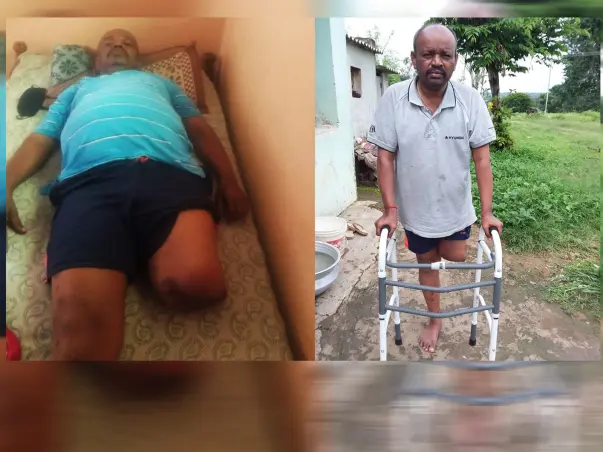 Help Rajanna To Purchase Artificial Leg