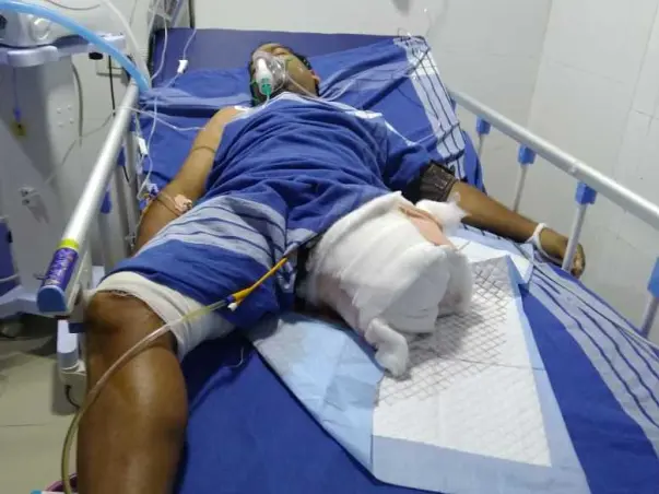 Support Venkatreddy Recover From Road Traffic Accident