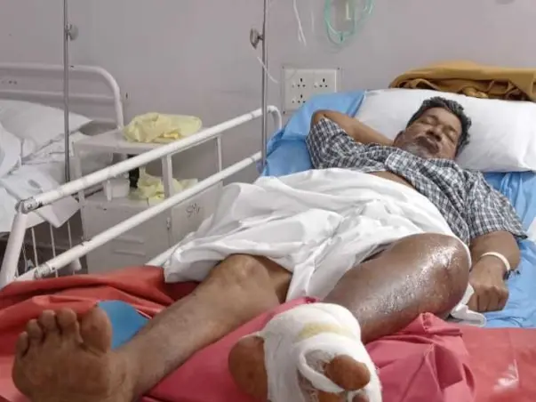 My Husband Is Suffering From Liver Cirrhosis. We Need Your Help To Provide For His Treatment