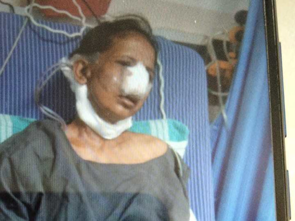 Support Sujatha Recover From Throat & Nose Cancer